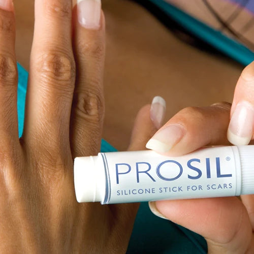 PROSIL® Silicone Scar Treatment Success